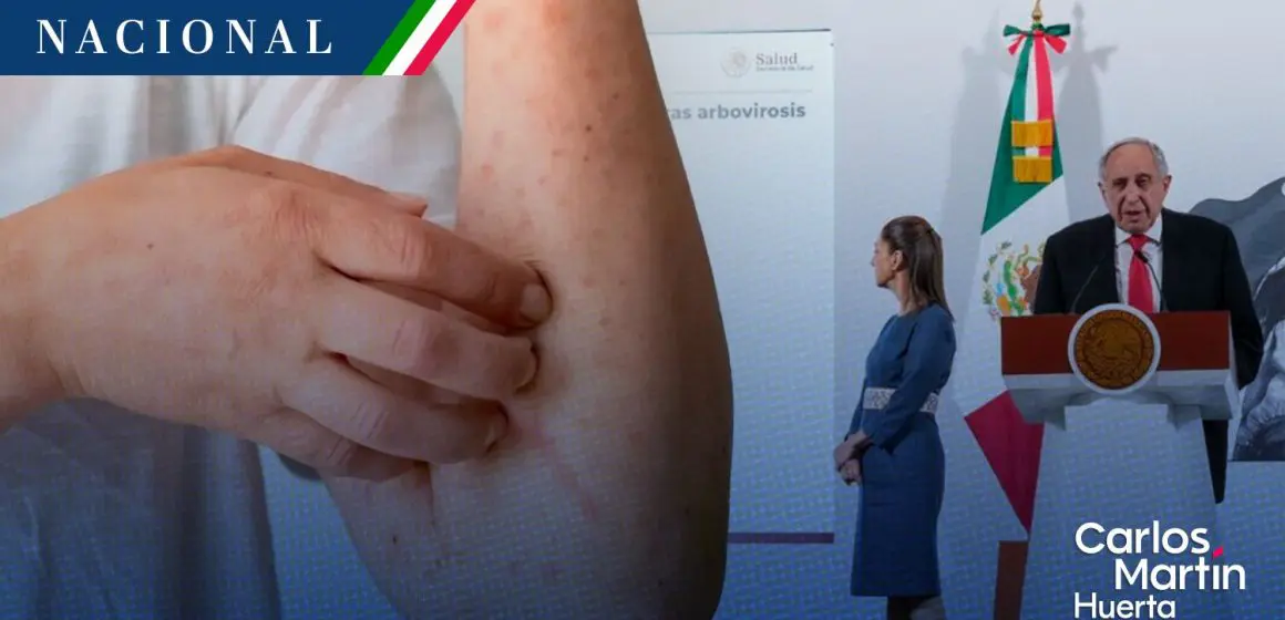 Salud presenta Plan Nacional contra el Dengue; se busca desarrollar vacuna