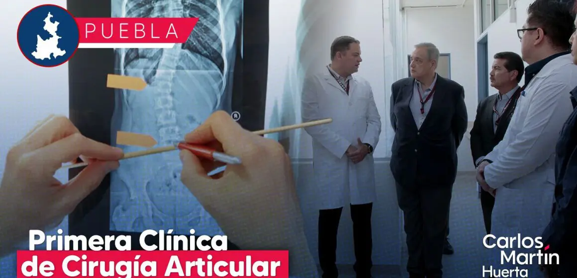 Puebla abrirá su primera Clínica de Cirugía Articular
