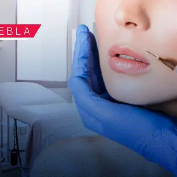 Se prohibirá la aplicación de bótox en establecimientos sin licencia en Puebla