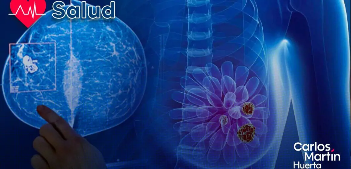 Nuevo avance contra el cáncer de mama: TIM-3, el talón de Aquiles de las células metastásicas