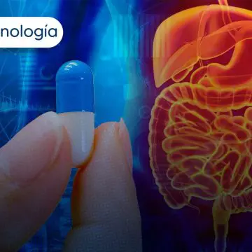 Cápsula inteligente revoluciona el tratamiento de la colitis con activación celular