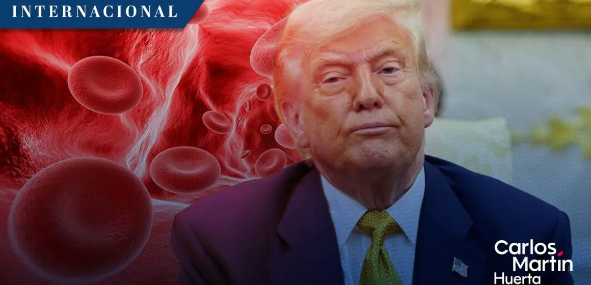 Trump diagnosticado con insuficiencia venosa crónica: Casa Blanca