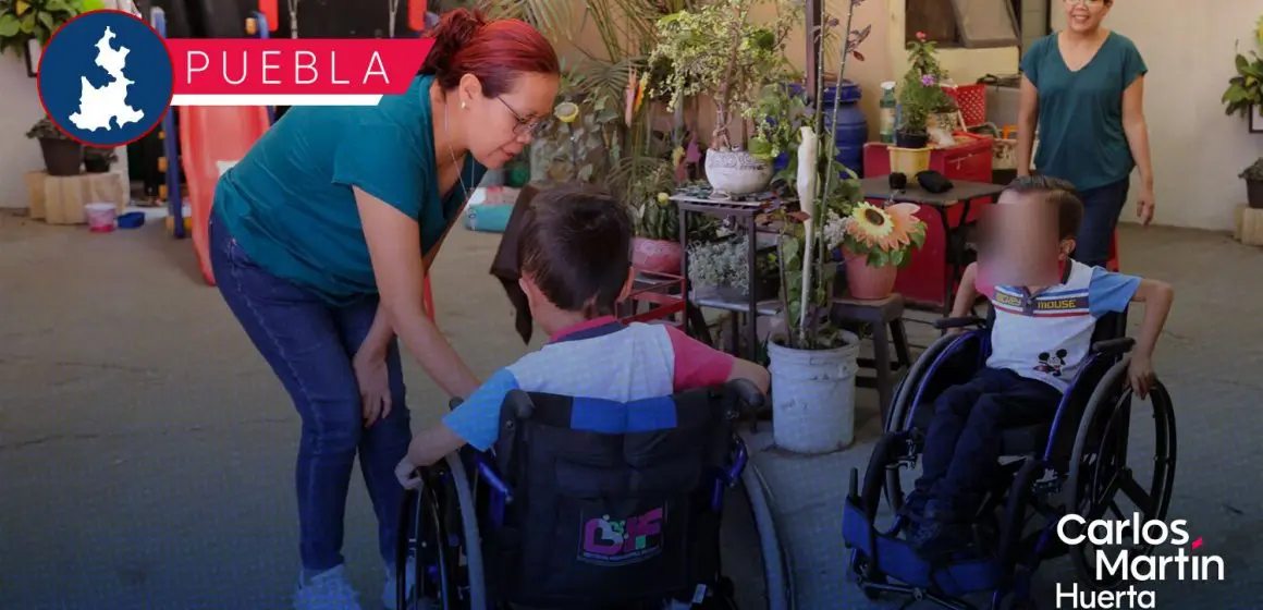 Mejoran la calidad de vida de Matías, un niño con hidrocefalia