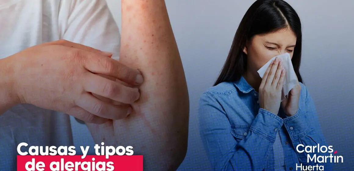 Día Internacional de las Alergias: causas, tipos más comunes y cómo prevenirlas