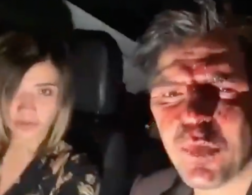 (VIDEO) Hijo de Lupita D´Alessio denuncia que familia de Arturo Montiel lo golpeó