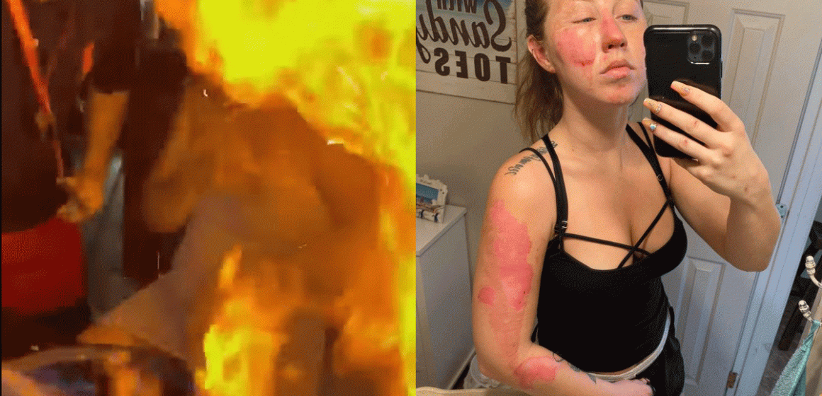 (VIDEO) Mesero quema rostro a turista en Cancún al preparar bebida flameada