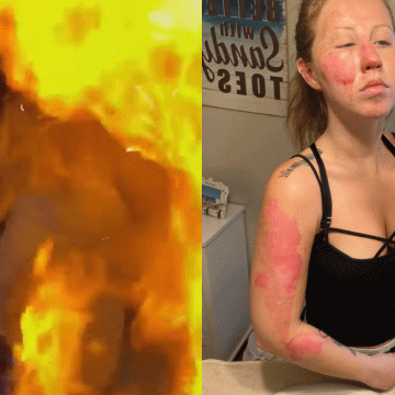 (VIDEO) Mesero quema rostro a turista en Cancún al preparar bebida flameada