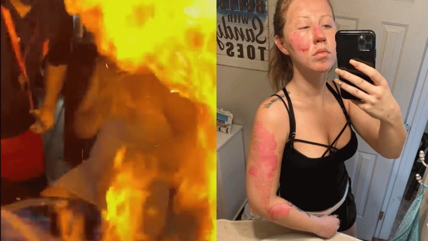 turista quemada Cancun CMH (VIDEO) Mesero quema rostro a turista en Cancún al preparar bebida flameada