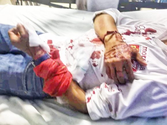 Atacan a balazos y dejan herido al candidato de Morena en Ocoyucan