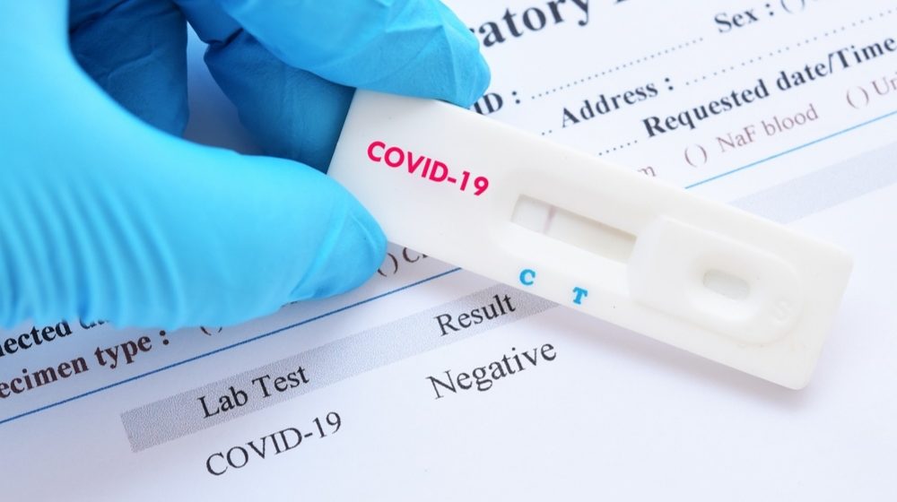 En Brasil un paciente dio positivo a Covid-19 durante 218 días