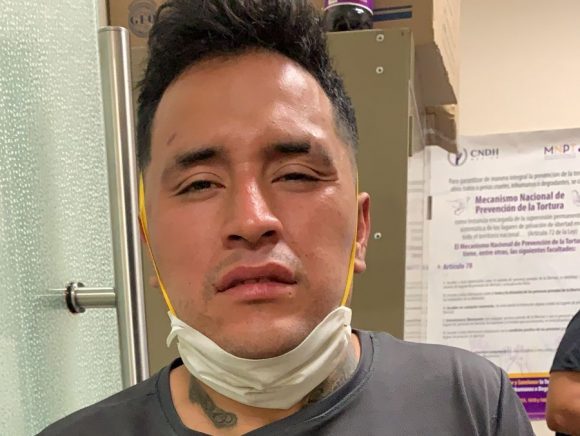 58723465892346587234502349576398475623984375 Delincuente escapó de la custodia de policías municipales en el C5