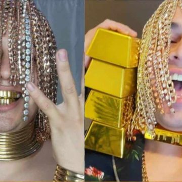 Rapero mexicano se implanta cadenas de oro en la cabeza