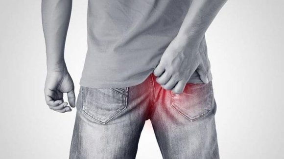 ¿Síndrome del ano inquieto?; nueva secuela detectada en paciente Covid-19