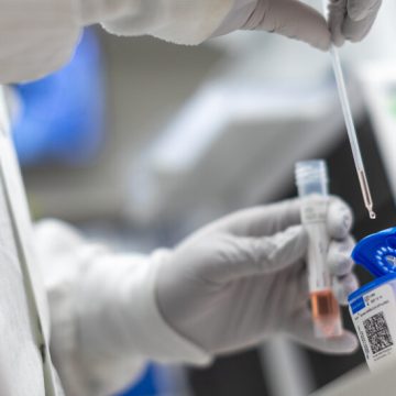 Detecta Israel primer caso de flurona, infección de Covid y gripe simultáneas