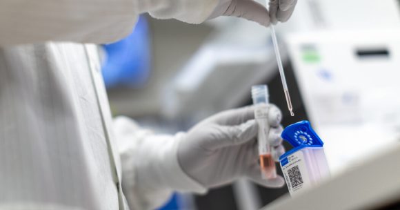 Detecta Israel primer caso de flurona, infección de Covid y gripe simultáneas