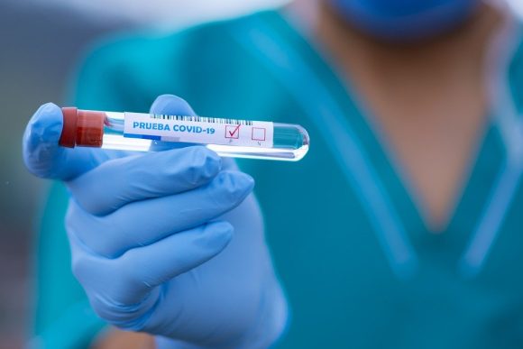 Hallan subvariante del COVID Ómicron