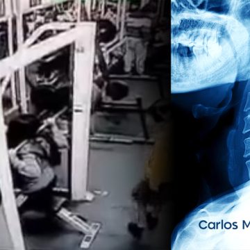 (VIDEO) Le caen a mujer 180 kilos en la nuca