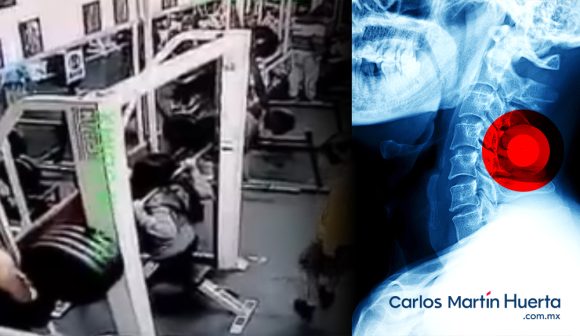 (VIDEO) Le caen a mujer 180 kilos en la nuca