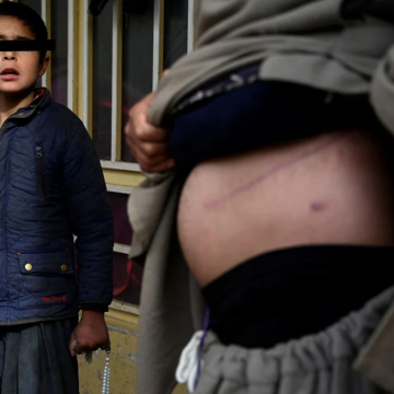 En Afganistan venden su riñon para darle comida a sus hijos