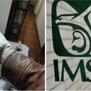 Colocan yeso a paciente en el IMSS, sin quitarle la chamarra