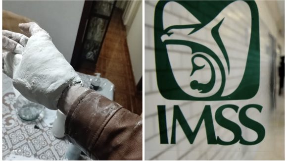 Colocan yeso a paciente en el IMSS, sin quitarle la chamarra
