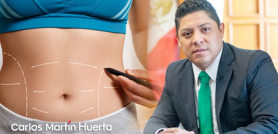 Proponen programa de liposucciones en San Luis Potosí