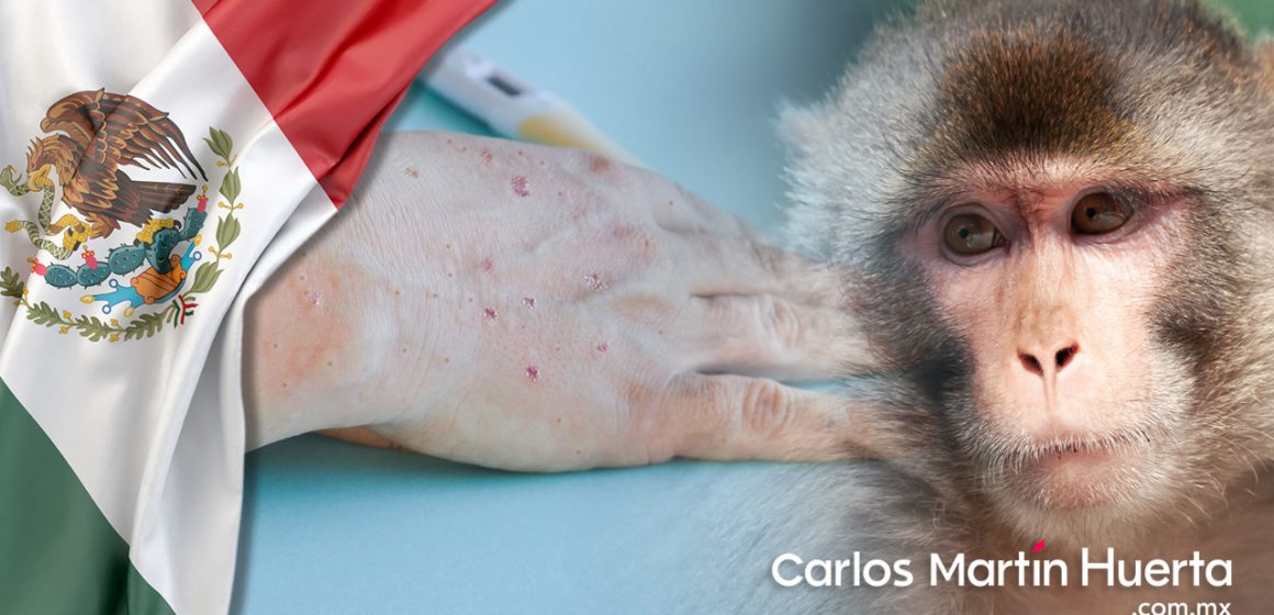 México supera los mil casos de viruela del mono