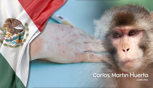 Suman 252 contagios de viruela símica en 20 entidades del país