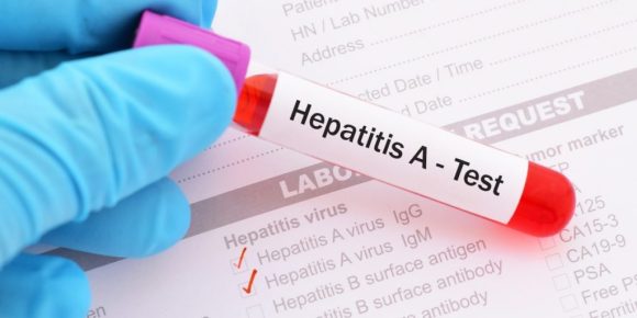 Reportan 650 casos de hepatitis infantil aguda en el mundo: OMS