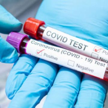 Test revela cuánto dura protección de vacunas contra COVID-19; será de fácil acceso