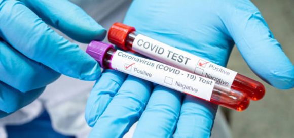 Test revela cuánto dura protección de vacunas contra COVID-19; será de fácil acceso