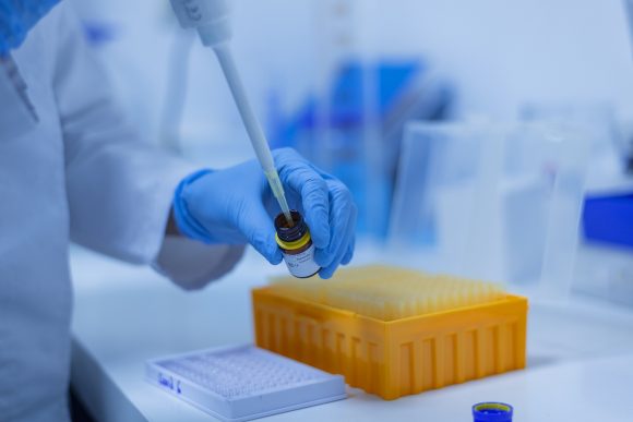 Investigadores hallan ADN de la viruela del mono en semen humano