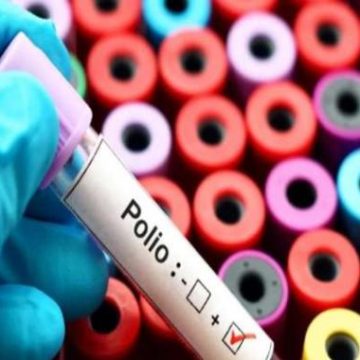 Hallan virus de la poliomielitis en aguas residuales de Londres