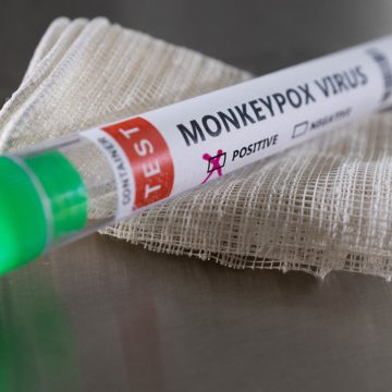 Evaluará OMS si viruela del mono es “emergencia de salud internacional”