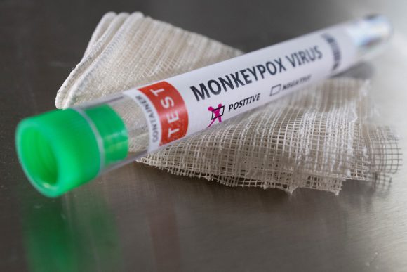 Evaluará OMS si viruela del mono es “emergencia de salud internacional”