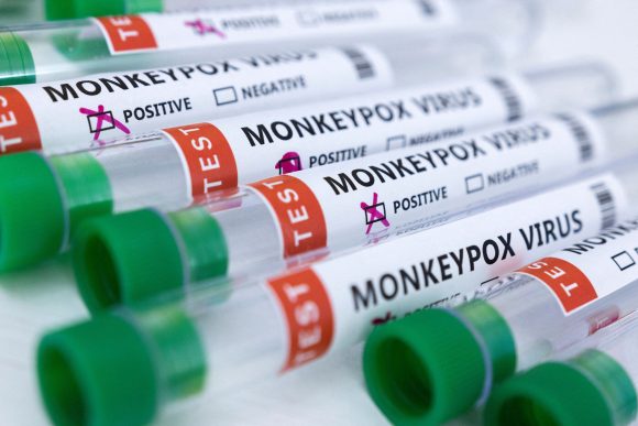Segunda muerte por viruela símica en España en menos de 24 horas