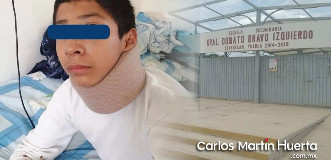 Golpean brutalmente a estudiante en escuela de Coxcatlán;  sufre fractura de tabique y lesiones cervicales