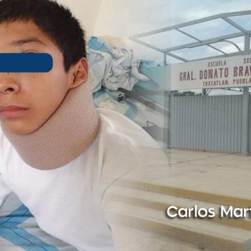 Golpean brutalmente a estudiante en escuela de Coxcatlán;  sufre fractura de tabique y lesiones cervicales