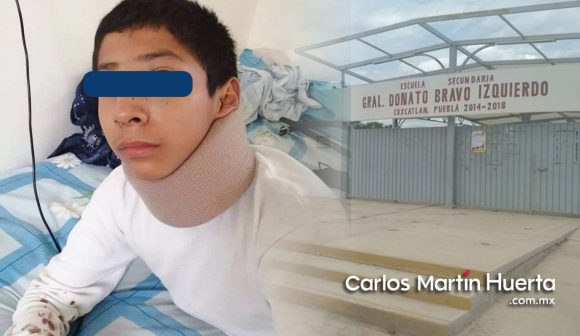 Golpean brutalmente a estudiante en escuela de Coxcatlán;  sufre fractura de tabique y lesiones cervicales