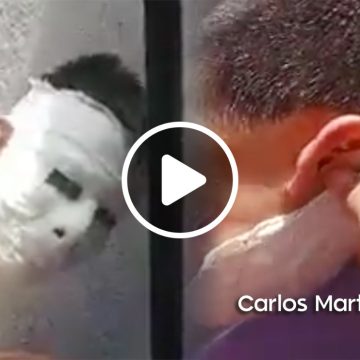 (VIDEO) Hace máscara de yeso de tarea y se le queda pegada al rostro