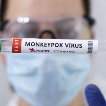 Brasil confirma primera muerte por causa de viruela del mono