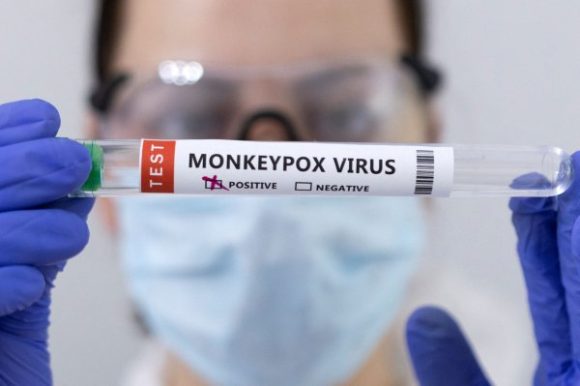 Brasil confirma primera muerte por causa de viruela del mono