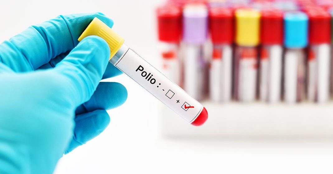 Detectan primer caso de poliomielitis en Nueva York