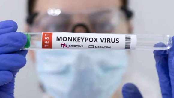 EU declara el brote de la viruela del mono como emergencia de salud pública