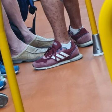Hombre contagiado con viruela símica viaja en Metro de España