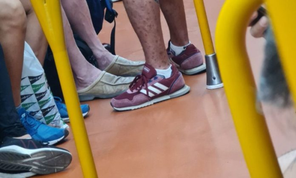 Hombre contagiado con viruela símica viaja en Metro de España