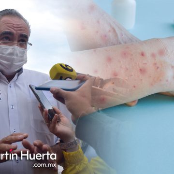 Sin casos sospechosos de viruela símica en Puebla en este 2023: Salud