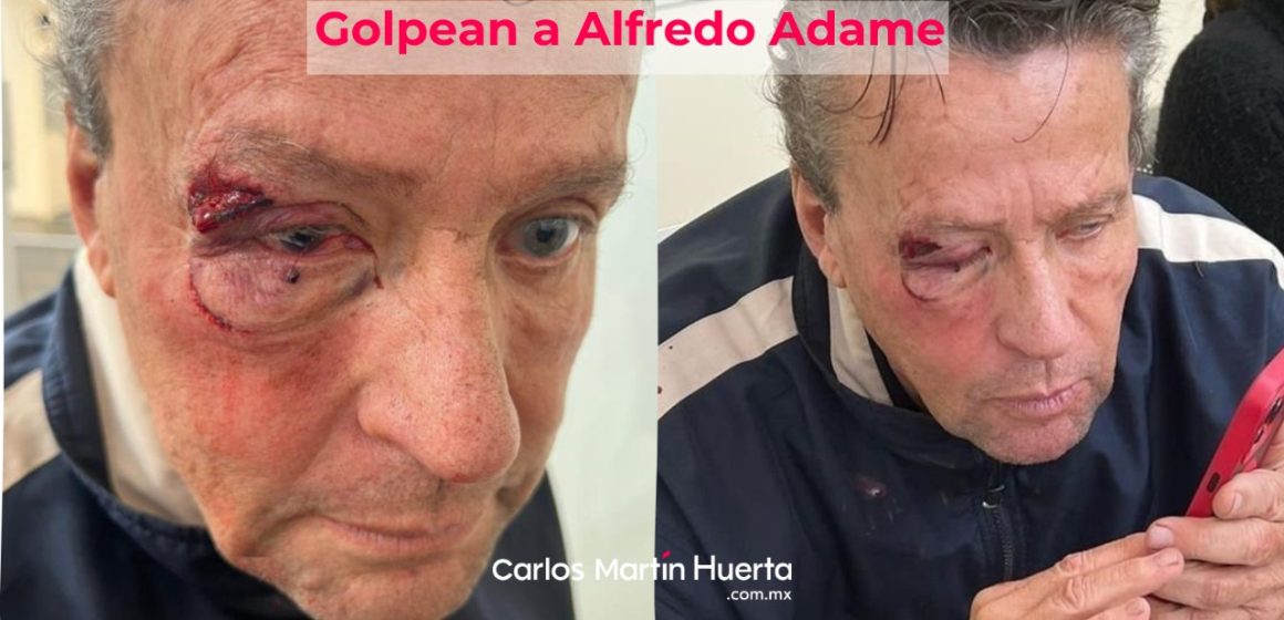 Por intentar grabar una balacera Alfredo Adame es golpeado