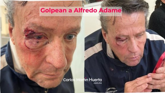 Por intentar grabar una balacera Alfredo Adame es golpeado