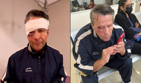 Balacera en Tlalpan deja una persona muerta, Adame golpeado y dos detenidos